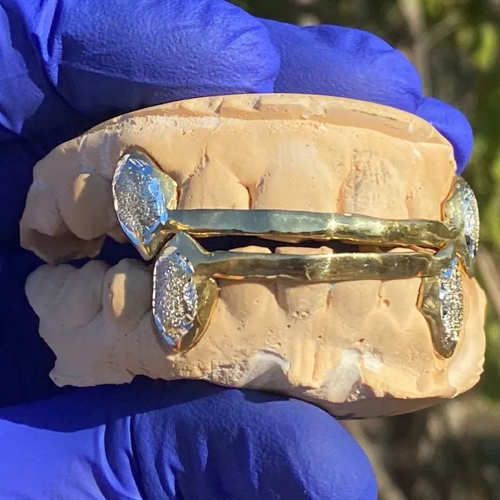 Bling Cartel Admin Solid 10K Gold Diamond Dust Vampire Fang Custom Grillz PreStyled Sets