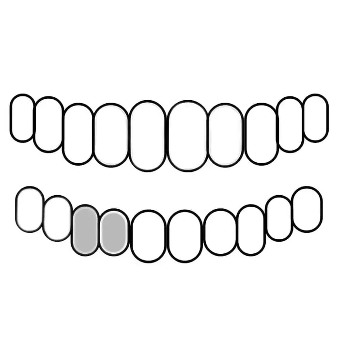 PreStyled Sets Real 10K White Gold Double Caps Side Canine Custom Grillz Bling Cartel Admin